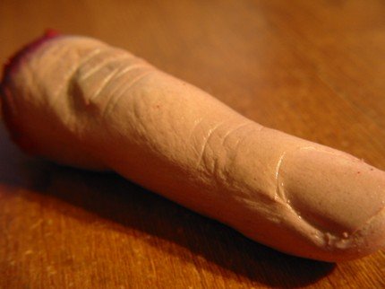 ��(g��)�Ԅ�(chu��ng  )��Ѫ����ָU�P(p��n)