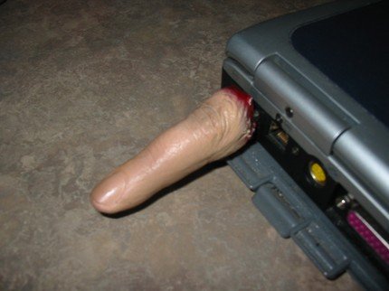 ��(g��)�Ԅ�(chu��ng  )��Ѫ����ָU�P(p��n)