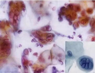 ���(l��i)ϴ���ӣ��������ךW���M(j��n)�ھ�ϴ�O���ꑌ�������Ҽ�